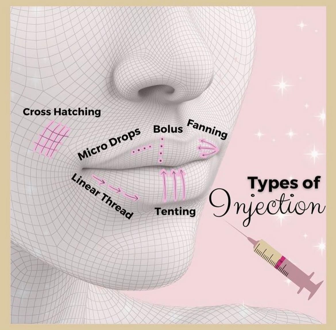 Types of Lip Injection